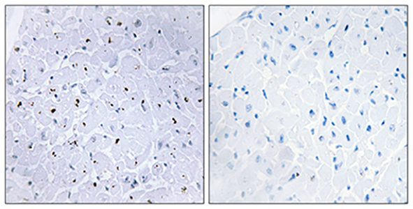 53BP1 (phospho Ser6) Rabbit Polyclonal Antibody | 兔多抗 | EnkiLife恩玑生命