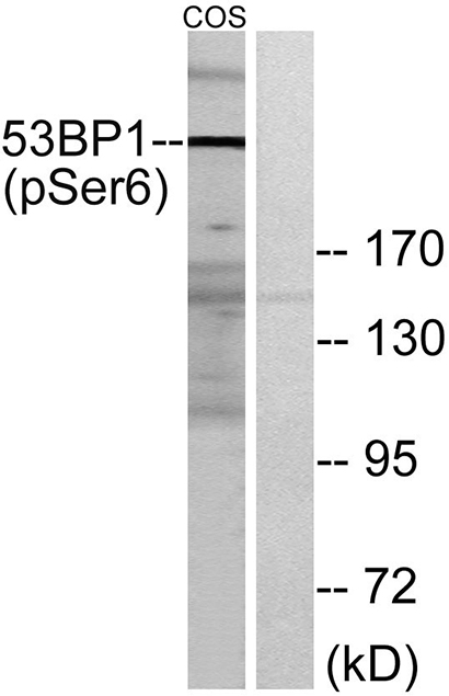 53BP1 (phospho Ser6) Rabbit Polyclonal Antibody | 兔多抗 | EnkiLife恩玑生命