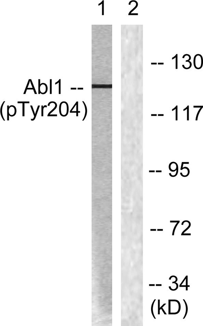 Abl1 (phospho Tyr204) Rabbit Polyclonal Antibody | 兔多抗 | EnkiLife恩玑生命