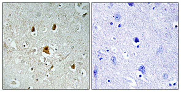 Abl1 (phospho Tyr204) Rabbit Polyclonal Antibody | 兔多抗 | EnkiLife恩玑生命