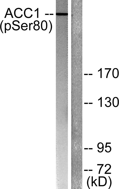 ACCα (phospho Ser80) Rabbit Polyclonal Antibody | 兔多抗 | EnkiLife恩玑生命