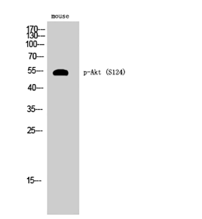 Akt (phospho Ser124) Rabbit Polyclonal Antibody | 兔多抗 | EnkiLife恩玑生命