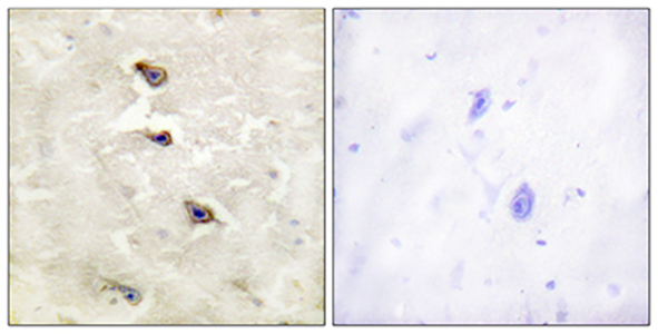 ALK (phospho Tyr1507) Rabbit Polyclonal Antibody | 兔多抗 | EnkiLife恩玑生命