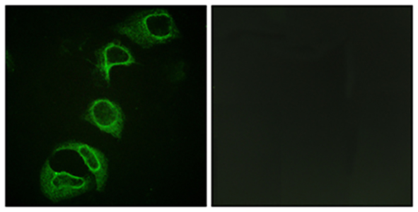 ALK (phospho Tyr1604) Rabbit Polyclonal Antibody | 兔多抗 | EnkiLife恩玑生命