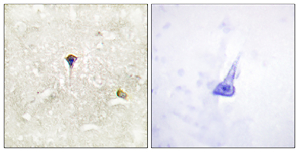 ALK (phospho Tyr1604) Rabbit Polyclonal Antibody | 兔多抗 | EnkiLife恩玑生命