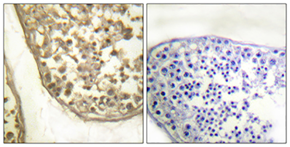 AP-1 (phospho Thr231) Rabbit Polyclonal Antibody | 兔多抗 | EnkiLife恩玑生命