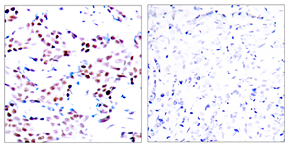 AP-1 (phospho Thr91) Rabbit Polyclonal Antibody | 兔多抗 | EnkiLife恩玑生命