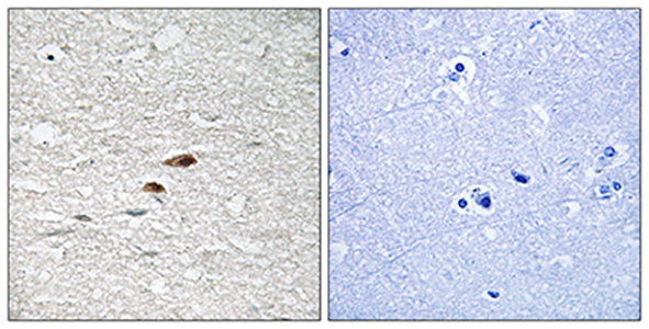 APC (phospho Ser2054) Rabbit Polyclonal Antibody | 兔多抗 | EnkiLife恩玑生命