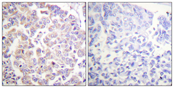 APC1 (phospho Ser688) Rabbit Polyclonal Antibody | 兔多抗 | EnkiLife恩玑生命