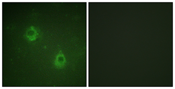 APC1 (phospho Ser688) Rabbit Polyclonal Antibody | 兔多抗 | EnkiLife恩玑生命