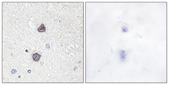 AQP2 (phospho Ser256) Rabbit Polyclonal Antibody | 兔多抗 | EnkiLife恩玑生命