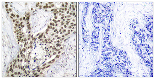 AR (phospho Ser213) Rabbit Polyclonal Antibody | 兔多抗 | EnkiLife恩玑生命
