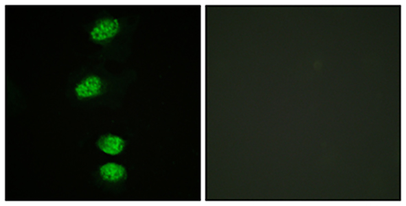 AR (phospho Ser94) Rabbit Polyclonal Antibody | 兔多抗 | EnkiLife恩玑生命