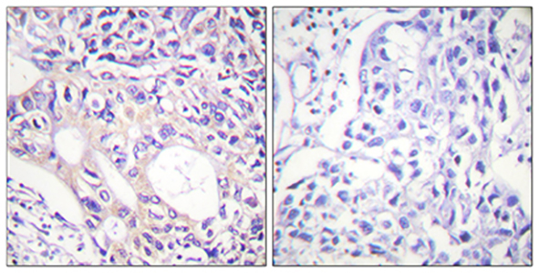 ARK-1 (phospho Thr288) Rabbit Polyclonal Antibody | 兔多抗 | EnkiLife恩玑生命