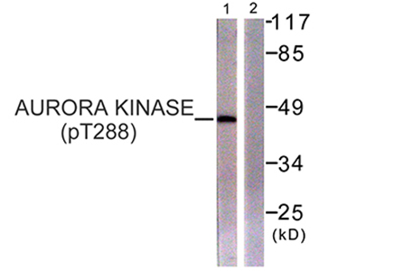 ARK-1 (phospho Thr288) Rabbit Polyclonal Antibody | 兔多抗 | EnkiLife恩玑生命