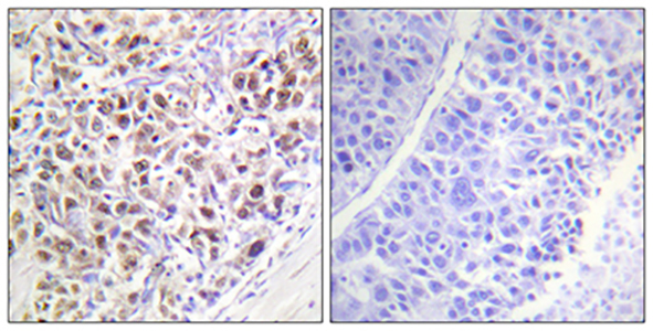 ARK-2 (phospho Thr232) Rabbit Polyclonal Antibody | 兔多抗 | EnkiLife恩玑生命