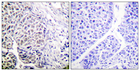 ARK-2 (phospho Tyr12) Rabbit Polyclonal Antibody | 兔多抗 | EnkiLife恩玑生命