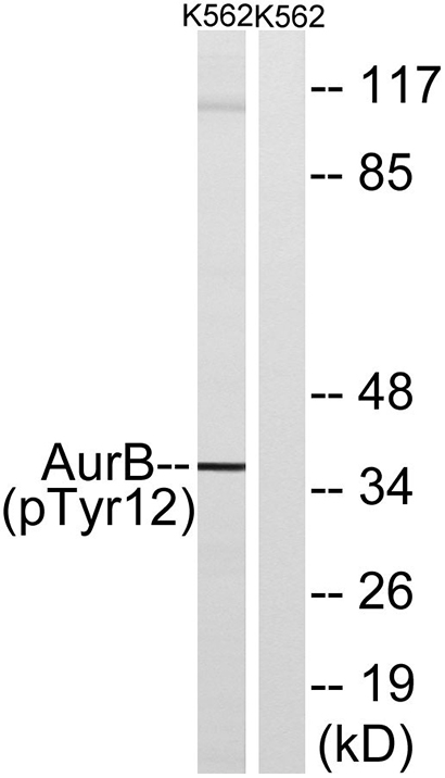 ARK-2 (phospho Tyr12) Rabbit Polyclonal Antibody | 兔多抗 | EnkiLife恩玑生命