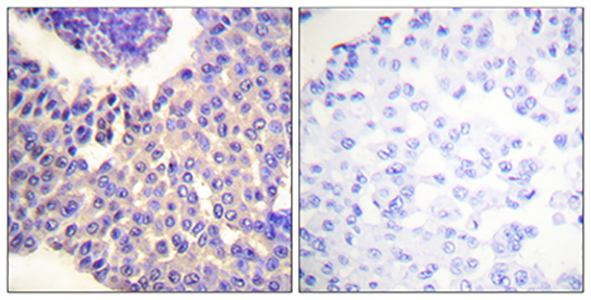 Arrestin-β-1 (phospho Ser412) Rabbit Polyclonal Antibody | 兔多抗 | EnkiLife恩玑生命