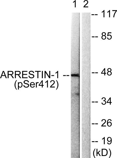 Arrestin-β-1 (phospho Ser412) Rabbit Polyclonal Antibody | 兔多抗 | EnkiLife恩玑生命