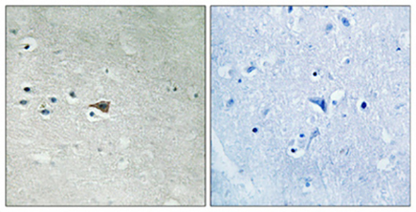 Arrestin-β-1 (phospho Ser412) Rabbit Polyclonal Antibody | 兔多抗 | EnkiLife恩玑生命