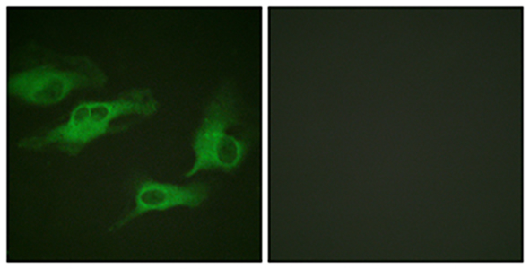 AR-β2 (phospho Ser346) Rabbit Polyclonal Antibody | 兔多抗 | EnkiLife恩玑生命