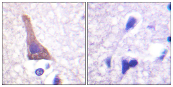 AR-β2 (phospho Ser346) Rabbit Polyclonal Antibody | 兔多抗 | EnkiLife恩玑生命