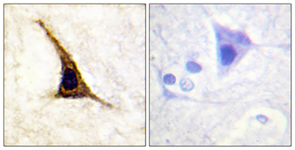 AR-β2 (phospho Ser355/S356) Rabbit Polyclonal Antibody | 兔多抗 | EnkiLife恩玑生命