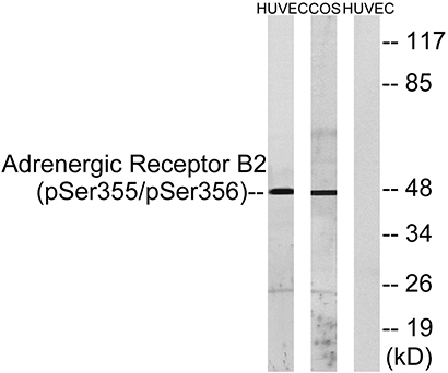 AR-β2 (phospho Ser355/S356) Rabbit Polyclonal Antibody | 兔多抗 | EnkiLife恩玑生命