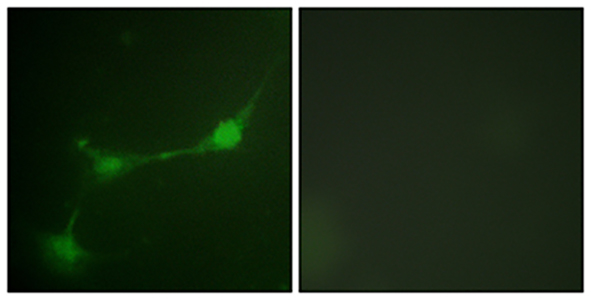 Ataxin-1 (phospho Ser776) Rabbit Polyclonal Antibody | 兔多抗 | EnkiLife恩玑生命