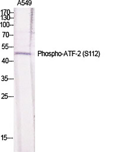 ATF-2 (phospho Ser112) Rabbit Polyclonal Antibody | 兔多抗 | EnkiLife恩玑生命