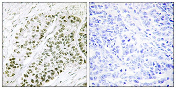 ATF-2 (phospho Ser480) Rabbit Polyclonal Antibody | 兔多抗 | EnkiLife恩玑生命