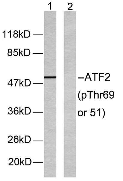 ATF-2 (phospho Thr69) Rabbit Polyclonal Antibody | 兔多抗 | EnkiLife恩玑生命