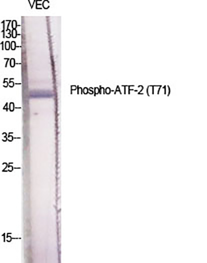ATF-2 (phospho Thr71) Rabbit Polyclonal Antibody | 兔多抗 | EnkiLife恩玑生命
