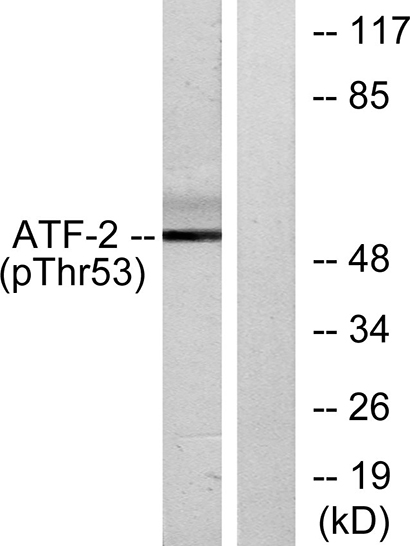 ATF-2 (phospho Thr71) Rabbit Polyclonal Antibody | 兔多抗 | EnkiLife恩玑生命