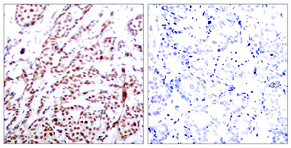 ATF-2 (phospho Thr73) Rabbit Polyclonal Antibody | 兔多抗 | EnkiLife恩玑生命
