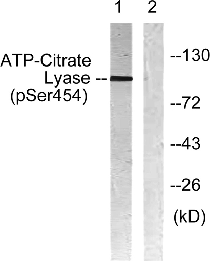 ATP-citrate synthase (phospho Ser455) Rabbit Polyclonal Antibody | 兔多抗 | EnkiLife恩玑生命
