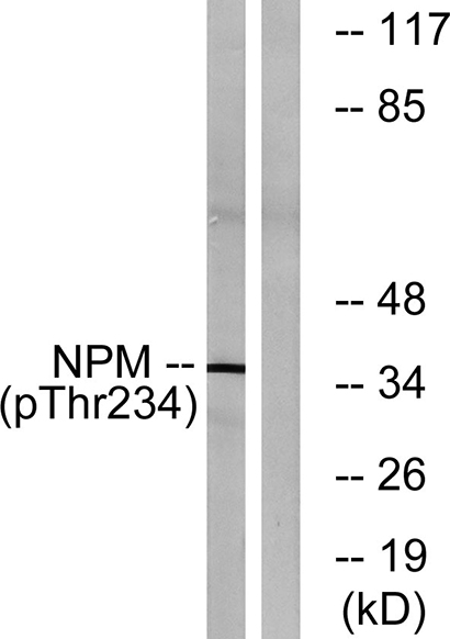 B23 (phospho Thr234) Rabbit Polyclonal Antibody | 兔多抗 | EnkiLife恩玑生命