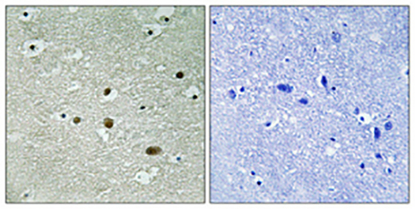 B23 (phospho Thr234) Rabbit Polyclonal Antibody | 兔多抗 | EnkiLife恩玑生命