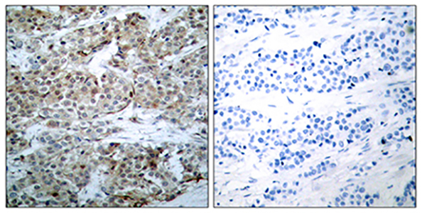 Bad (phospho Ser112) Rabbit Polyclonal Antibody | 兔多抗 | EnkiLife恩玑生命