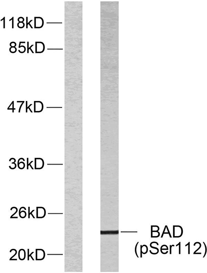 Bad (phospho Ser112) Rabbit Polyclonal Antibody | 兔多抗 | EnkiLife恩玑生命