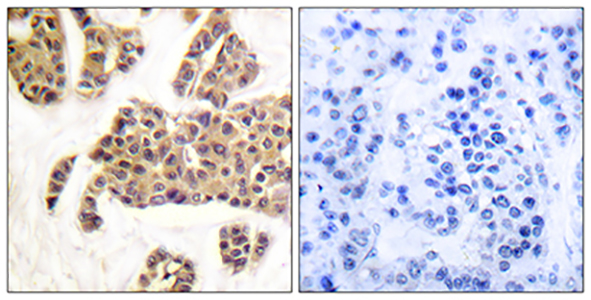 Bad (phospho Ser91) Rabbit Polyclonal Antibody | 兔多抗 | EnkiLife恩玑生命
