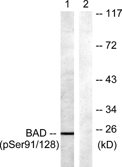 Bad (phospho Ser91) Rabbit Polyclonal Antibody | 兔多抗 | EnkiLife恩玑生命