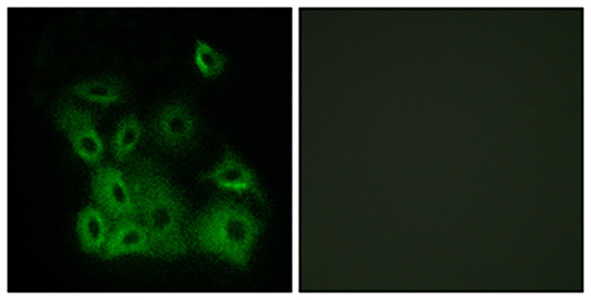 Bax (phospho Thr167) Rabbit Polyclonal Antibody | 兔多抗 | EnkiLife恩玑生命