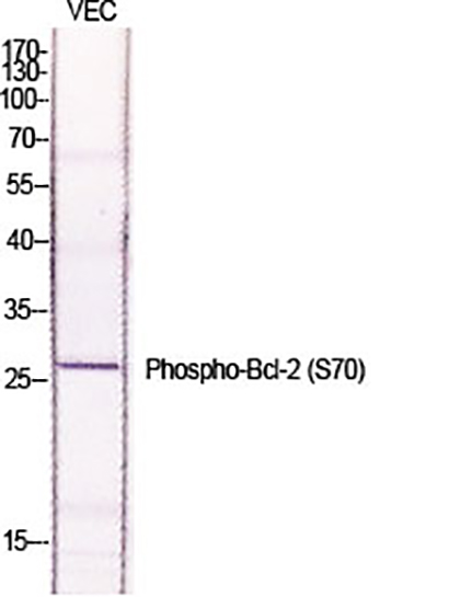 Bcl-2 (phospho Ser70) Rabbit Polyclonal Antibody | 兔多抗 | EnkiLife恩玑生命