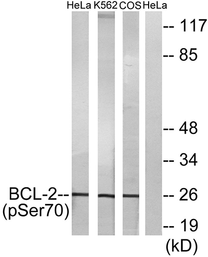 Bcl-2 (phospho Ser70) Rabbit Polyclonal Antibody | 兔多抗 | EnkiLife恩玑生命