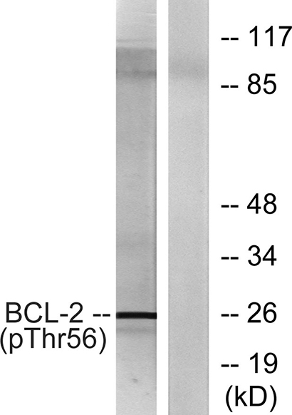Bcl-2 (phospho Thr56) Rabbit Polyclonal Antibody | 兔多抗 | EnkiLife恩玑生命
