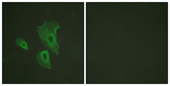 Bcl-2 (phospho Thr69) Rabbit Polyclonal Antibody | 兔多抗 | EnkiLife恩玑生命