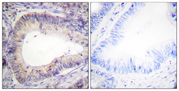 Bcl-2 (phospho Thr69) Rabbit Polyclonal Antibody | 兔多抗 | EnkiLife恩玑生命