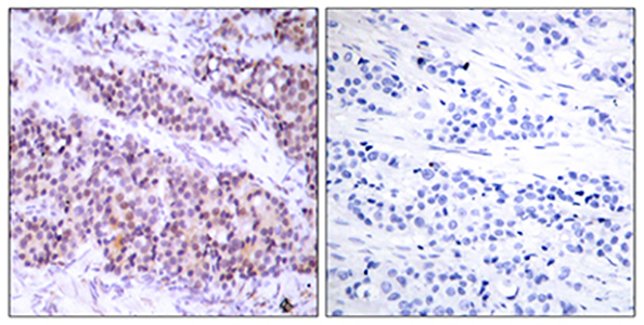 Bcl-x (phospho Ser62) Rabbit Polyclonal Antibody | 兔多抗 | EnkiLife恩玑生命